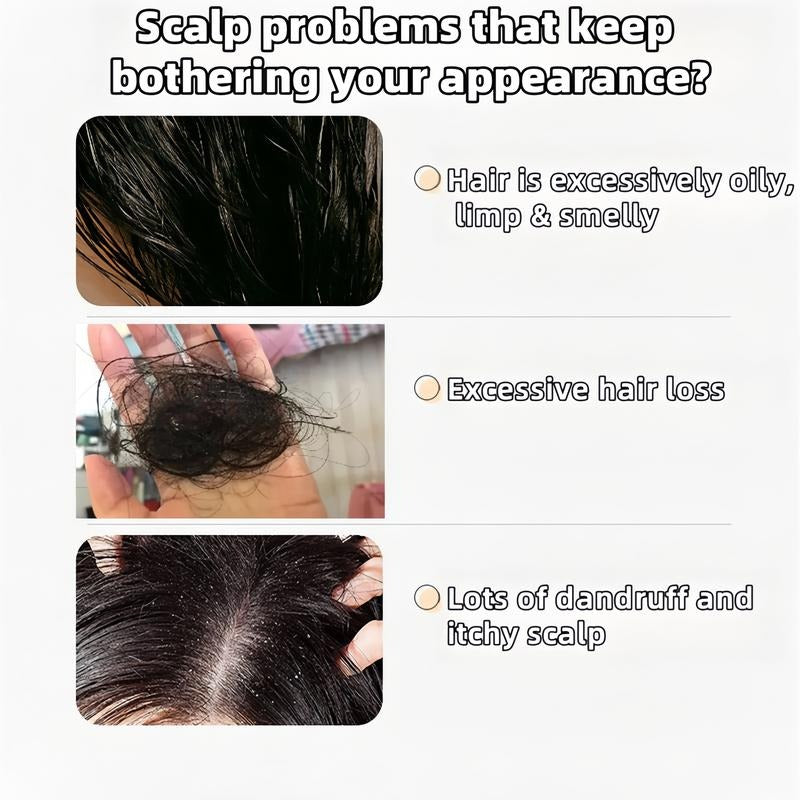 Anti-Hair Fall Shampoo: Ginseng & Ginger for Hair Growth, Oil & Dandruff Control. Buy 1 Get 1 Free. 300ML.